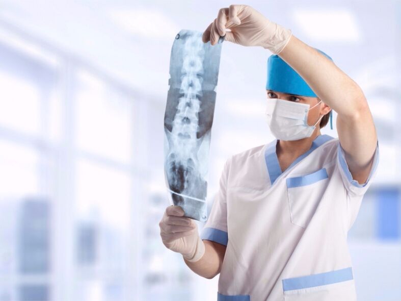de dokter kijkt naar een momentopname van de cervicale wervelkolom met osteochondrose