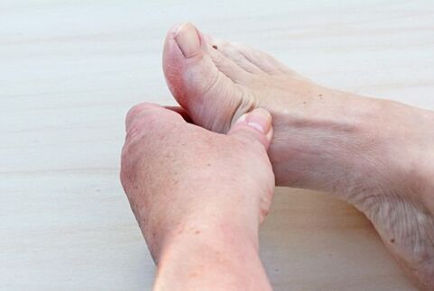 artrose van de voet