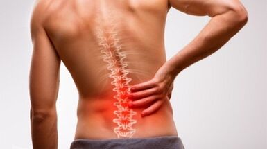 Tekenen en symptomen van osteochondrose van de lumbale wervelkolom