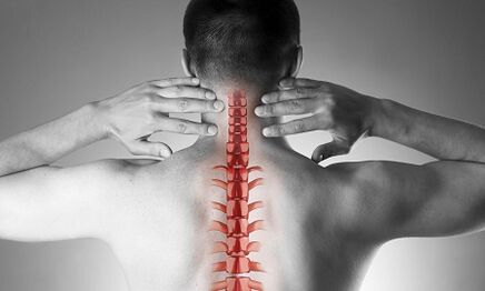 Hoe manifesteert osteochondrose van de cervicale wervelkolom zich